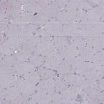 RSPH6A Antibody in Immunohistochemistry (IHC)