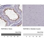 RSPH6A Antibody