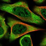 TXLNA Polyclonal Antibody