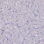 TXLNA Antibody in Immunohistochemistry (Paraffin) (IHC (P))