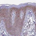 TXLNA Antibody in Immunohistochemistry (Paraffin) (IHC (P))