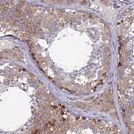 TXLNA Antibody in Immunohistochemistry (Paraffin) (IHC (P))