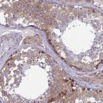 TXLNA Antibody in Immunohistochemistry (IHC)