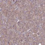 TXLNA Antibody in Immunohistochemistry (IHC)