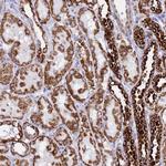 PKN3 Polyclonal Antibody