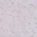 HTRA4 Antibody in Immunohistochemistry (Paraffin) (IHC (P))
