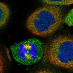 C17orf59 Polyclonal Antibody