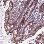 C17orf59 Antibody in Immunohistochemistry (Paraffin) (IHC (P))