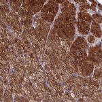 CLHC1 Polyclonal Antibody