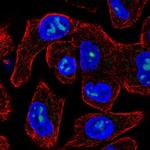 M1AP Polyclonal Antibody