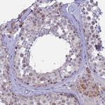 M1AP Antibody in Immunohistochemistry (Paraffin) (IHC (P))