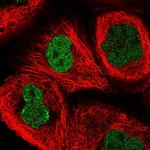 ATG16L2 Polyclonal Antibody