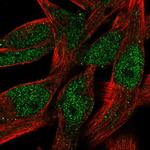 C5orf54 Polyclonal Antibody