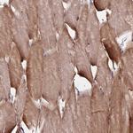 C5orf54 Antibody in Immunohistochemistry (Paraffin) (IHC (P))