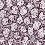 eIF3k Polyclonal Antibody