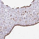 DSPG3 Polyclonal Antibody