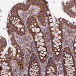 HECTD4 Antibody in Immunohistochemistry (Paraffin) (IHC (P))