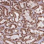 HECTD4 Antibody in Immunohistochemistry (Paraffin) (IHC (P))