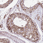 HECTD4 Polyclonal Antibody