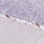 MPND Antibody in Immunohistochemistry (Paraffin) (IHC (P))