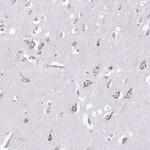 MPND Antibody in Immunohistochemistry (Paraffin) (IHC (P))