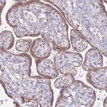 MPND Polyclonal Antibody