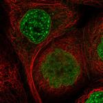 SIPA1L3 Polyclonal Antibody