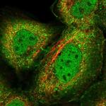 GMIP Polyclonal Antibody