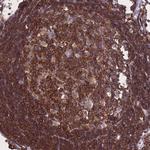 GMIP Antibody in Immunohistochemistry (Paraffin) (IHC (P))