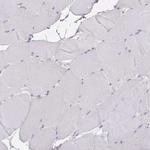 GMIP Antibody in Immunohistochemistry (IHC)