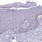 COX20 Antibody in Immunohistochemistry (Paraffin) (IHC (P))