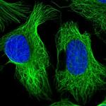 SKA1 Polyclonal Antibody