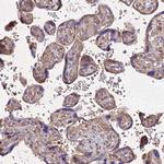 SKA1 Antibody in Immunohistochemistry (Paraffin) (IHC (P))