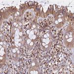 SKA1 Antibody in Immunohistochemistry (Paraffin) (IHC (P))