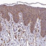 SKA1 Antibody in Immunohistochemistry (Paraffin) (IHC (P))