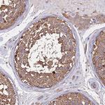 SKA1 Antibody in Immunohistochemistry (Paraffin) (IHC (P))