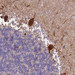 SLC24A3 Polyclonal Antibody