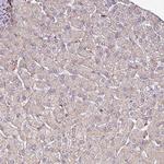 GPD2 Polyclonal Antibody