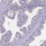 Sarcalumenin Antibody in Immunohistochemistry (IHC)