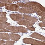 Sarcalumenin Antibody in Immunohistochemistry (IHC)