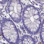 Sarcalumenin Antibody in Immunohistochemistry (IHC)