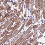Sarcalumenin Antibody in Immunohistochemistry (IHC)