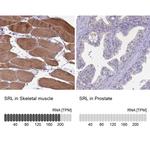 Sarcalumenin Antibody
