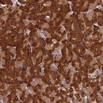 NXNL2 Polyclonal Antibody