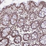 KIAA1486 Antibody in Immunohistochemistry (Paraffin) (IHC (P))