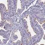 FAM166B Polyclonal Antibody