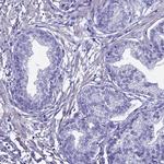 FAM166B Antibody in Immunohistochemistry (IHC)