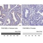 FAM166B Antibody