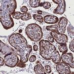 FAM195B Antibody in Immunohistochemistry (Paraffin) (IHC (P))