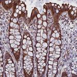 FAM195B Antibody in Immunohistochemistry (Paraffin) (IHC (P))